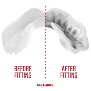 Protège-dents SAFEJAWZ | Blanc | MOUTHGUARD