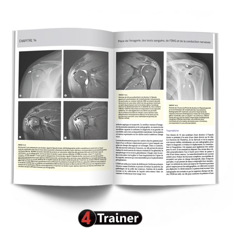 Livre L'Épaule Théorie et Pratique | 4Trainer